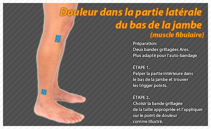 ares clinical taping - bruise