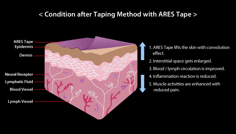 kinesiology tape method