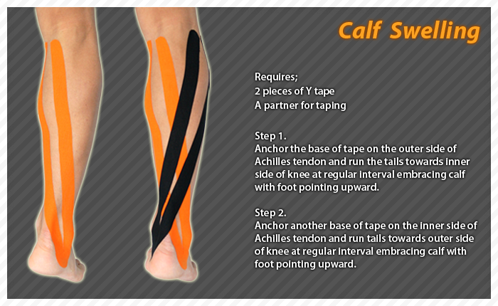 ares clinica taping-calf swelling