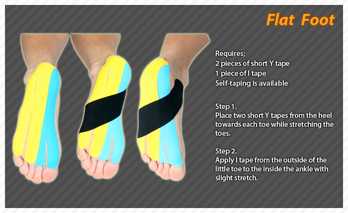 ares clinical taping - flat feet