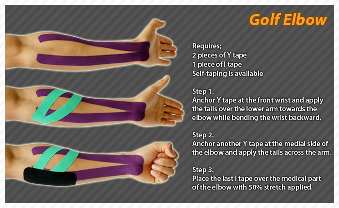 ares clinical taping-golf elbow
