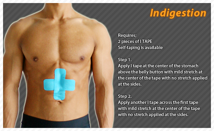 ares clinical taping-indigestion