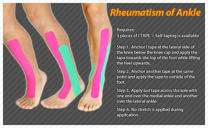 ares clinical taping - fheumatism ankle
