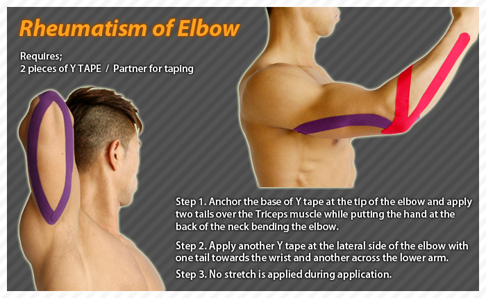 ares clinical taping - rheumatism elbow