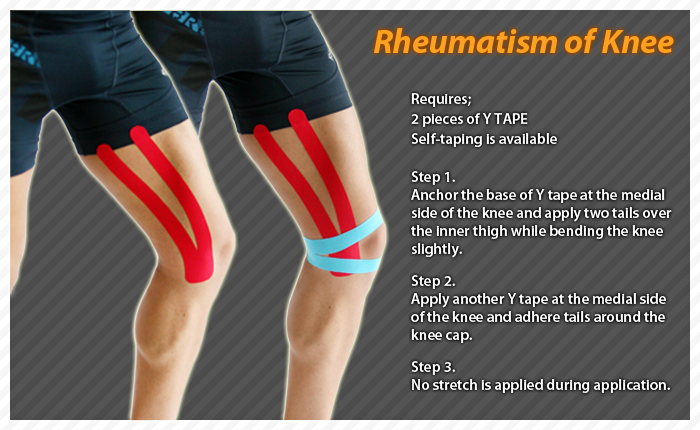 ares clinicla taping  - rheumatism knee