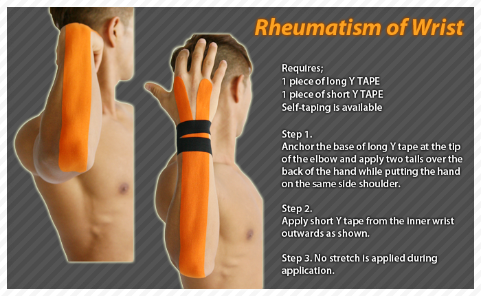 ares clinical taping - rheumatism