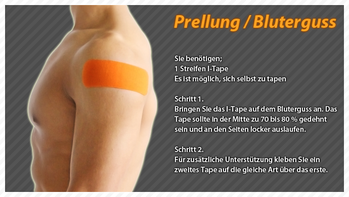 clinical taping-bruise