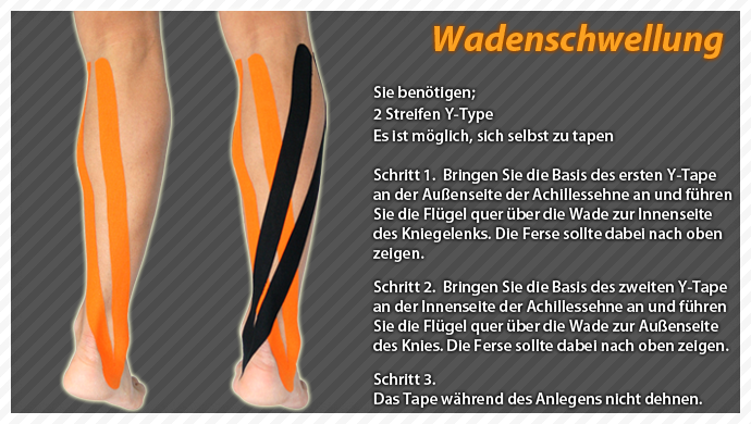 clinical taping-calf swelling