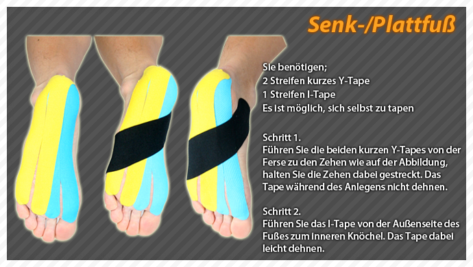 clinical taping-flat feet