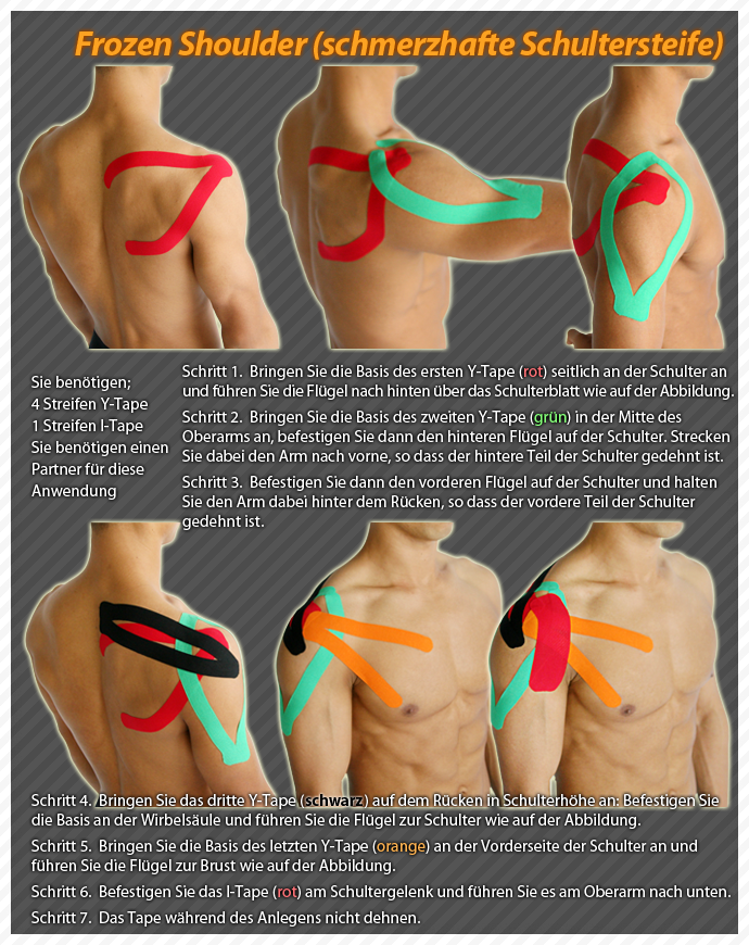 clinical taping-frozen shoulder