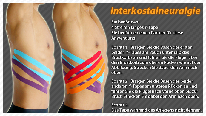 clinical taping-intercostal