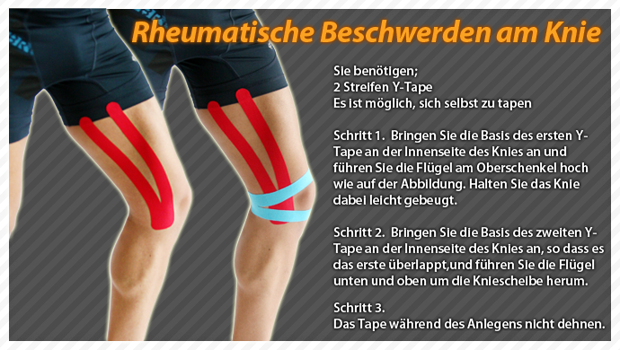 clinical taping-fheumatism knee