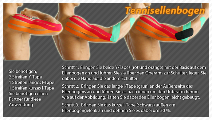 clinical taping-tennis elbow