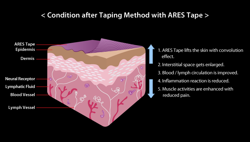 condition after taping method with ares tape