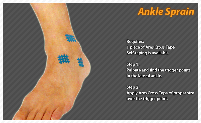 ares clinical taping - bruise