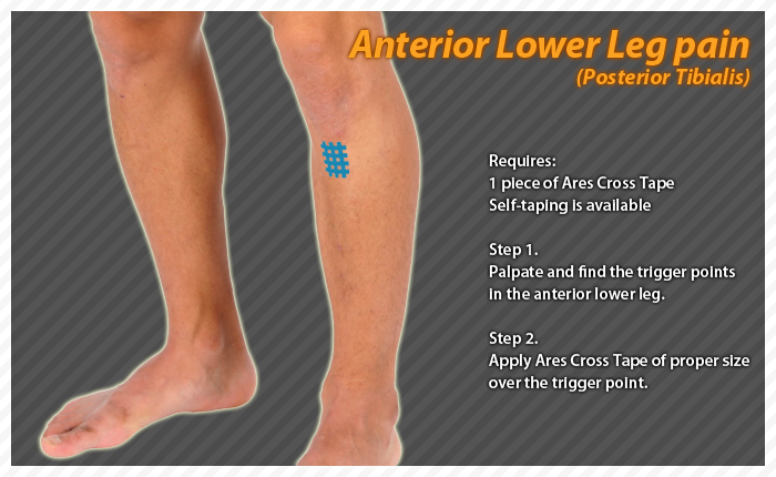 ares clinical taping - bruise