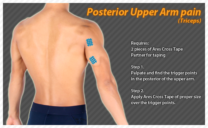 ares clinical taping - bruise