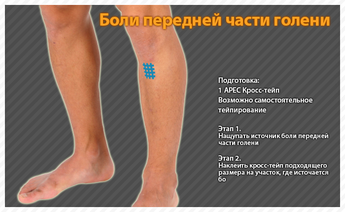 ares clinical taping - bruise