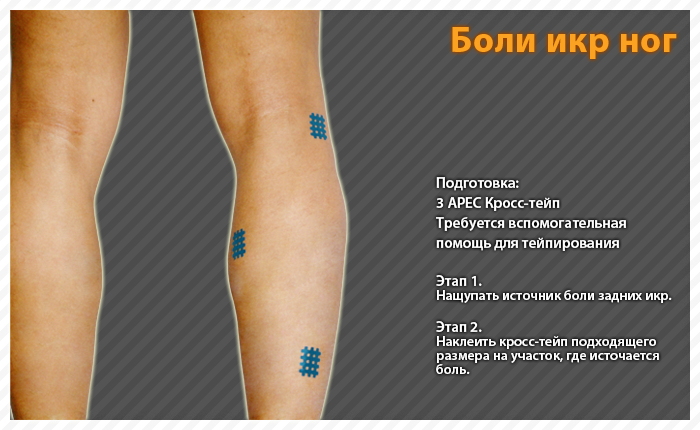 ares clinical taping - bruise