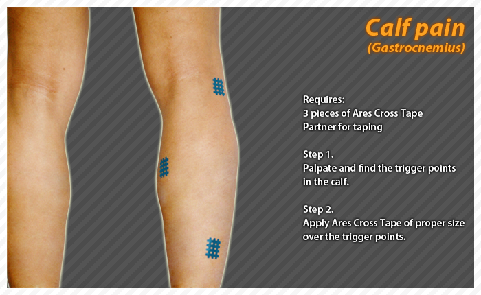 ares clinical taping - bruise